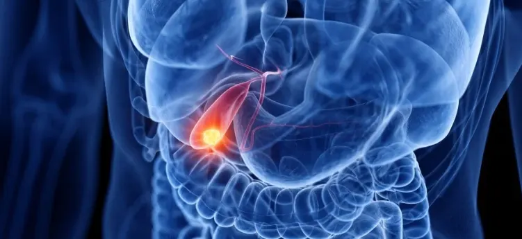 Bile Duct Surgery